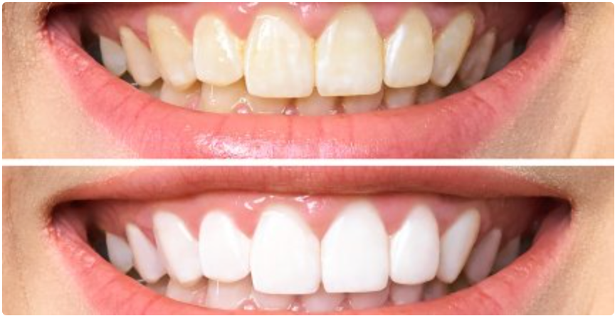 😁 UNA BOCA SALUDABLE, LIMPIA E IMPECABLE 🦷