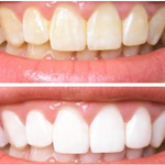 😁 UNA BOCA SALUDABLE, LIMPIA E IMPECABLE 🦷
